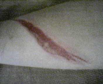 Av