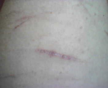 Av
