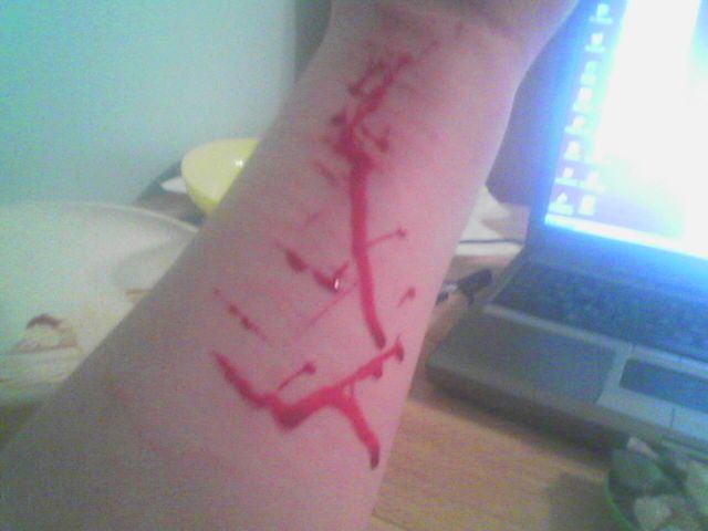 Bloody Wounds