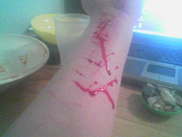 Bloody Wounds