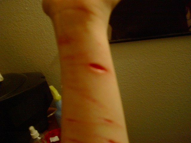 Katt
