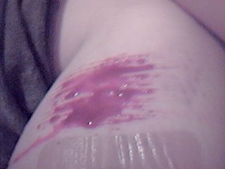 Kissing the Saw